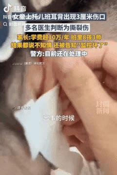 必须严惩！湖北武汉，一女子把孙女送进一家高端托儿所，每年费用10万多，结果9月1