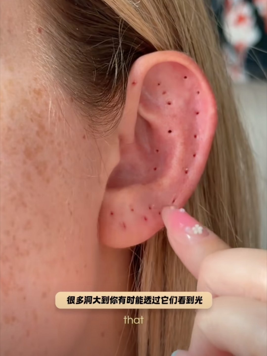 打了21个耳洞的耳朵我的天哪看着好吓人啊[皱眉][皱眉][皱眉] ​​​