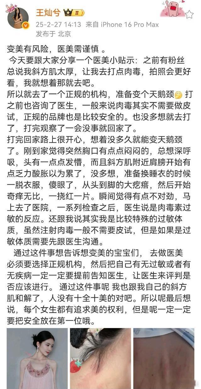 杜淳老婆打肉毒全身过敏  杜淳老婆自曝打肉毒全身过敏  杜淳老婆打肉毒过敏，啊这