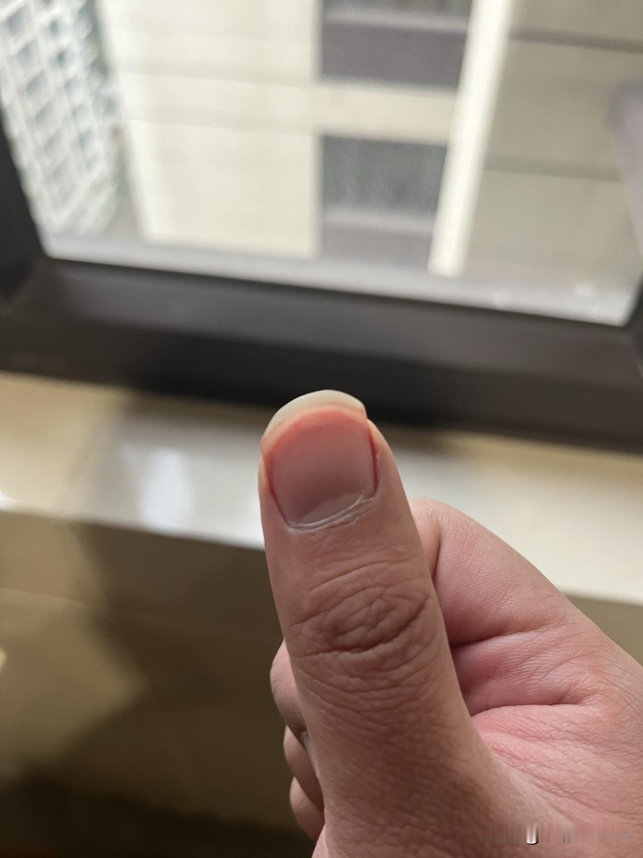 上午换衣服出门上班的时候，卫衣被羽绒服挤的太靠前了，我就想着往后拉一拉，没想到拉