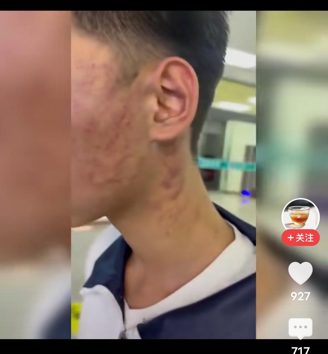 初中校园霸凌不仅是学生中，老师也是施暴者
第一张图，是山西一初中生被老师扇耳光的