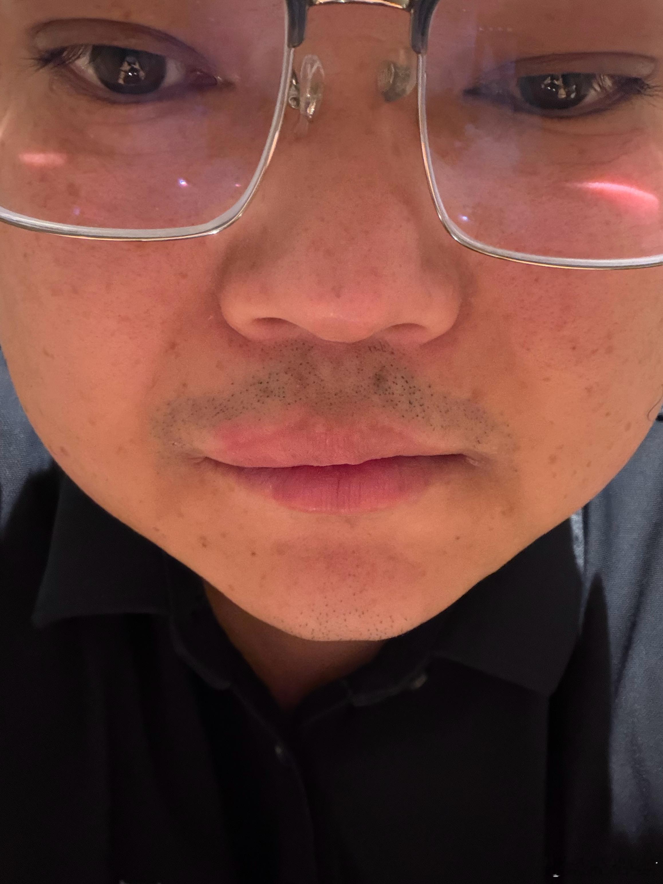 一觉睡醒嘴唇肿了，今天七夕，愿有爱者更爱，无爱者自由。 