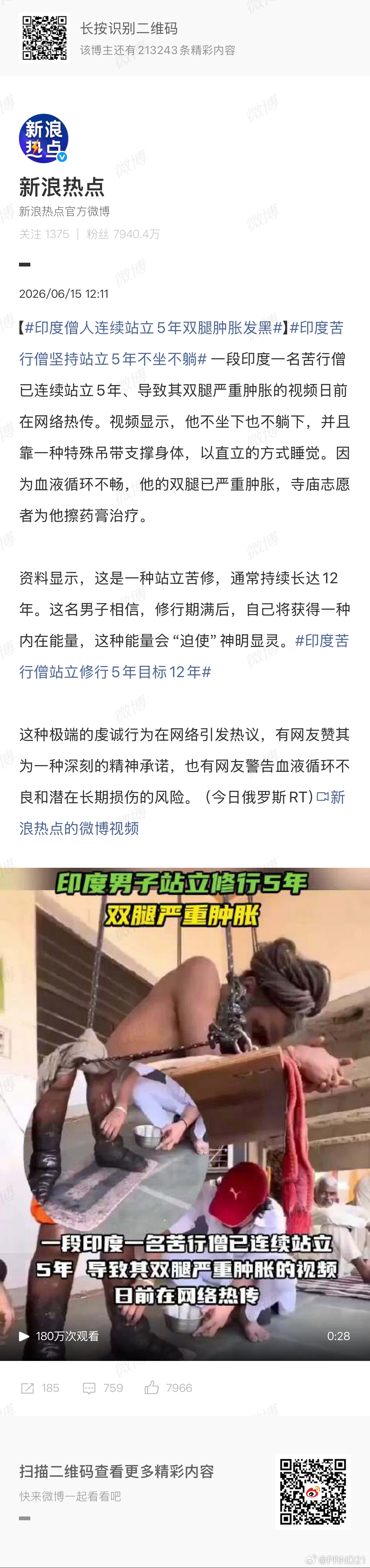 印度苦行僧坚持站立5年不坐不躺 怎么说呢，这是属于人家的信仰自由，他好这口，自己