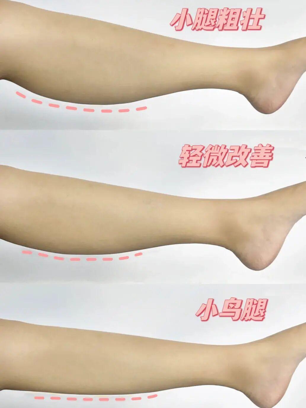 瘦小腿练它就对了！每天五分钟瘦腿太牛了！