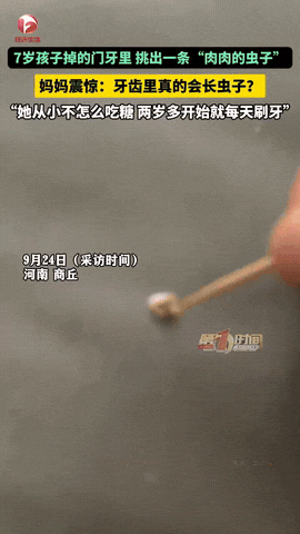这下真解释不清了！河南，一女子在自己7岁孩子脱落的门牙里挑出了一条肉肉的虫子。她