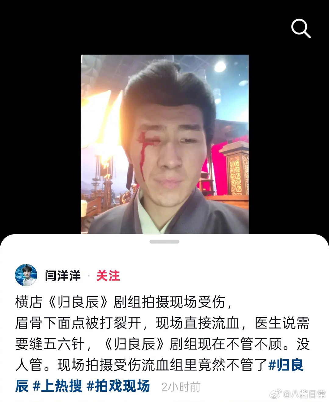 群演发文称在《归良辰》剧组拍摄受伤没人管 