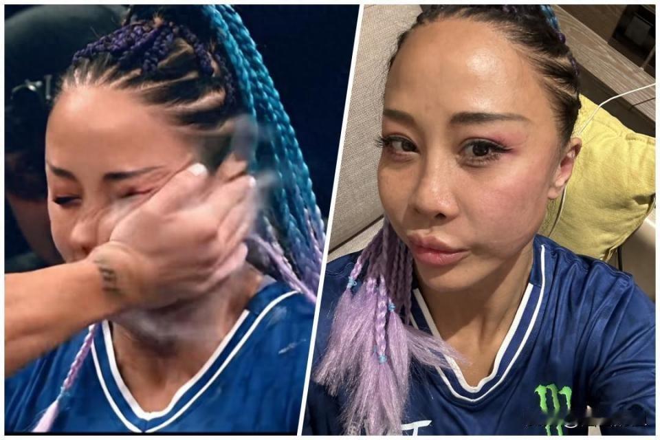 这大耳刮子，挨得是真硬气！有个叫丁苗的姑娘，去年跑阿布扎比参加“世界扇耳光大赛”