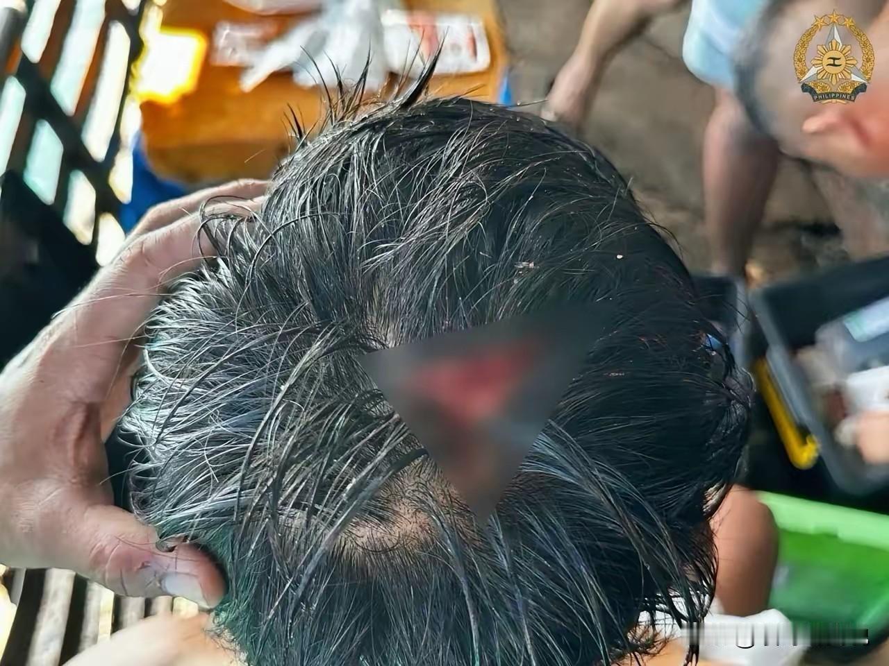 菲军人:  大家快来看啊，我的脑袋被中国海警给直接“开瓢”了！好惨啊！大家一定要