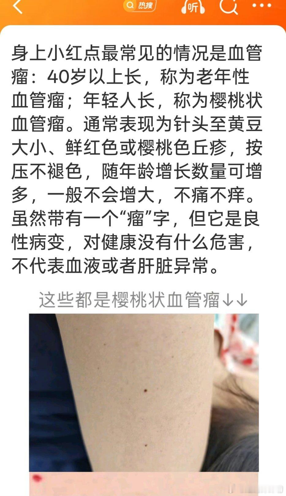 身上莫名长出的小红点是什么我胳膊上有两颗，我妈一直说是我熬夜把身体搞坏了，肝脏发