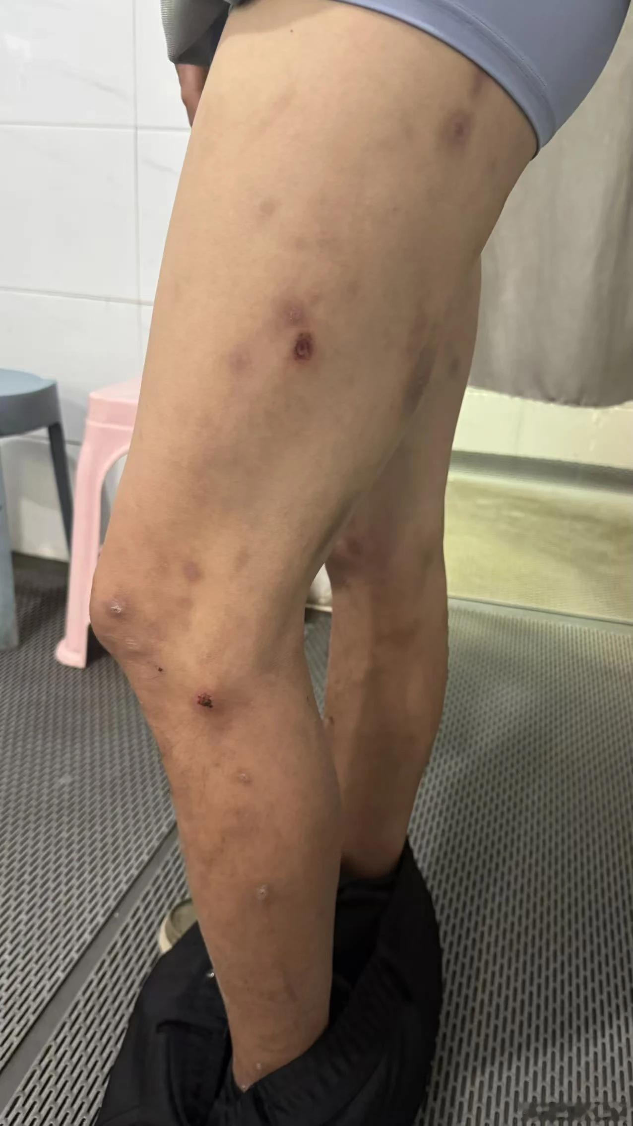 河北省定州市聋哑人被强迫劳动 希望刑事立案，网友来信:我弟弟是一个聋哑人，200
