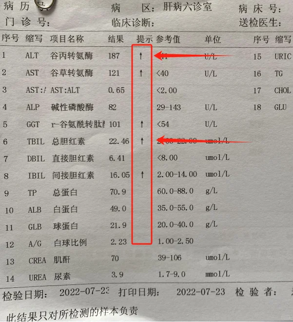 肝功能报告单上，留意这2项指标不要升高