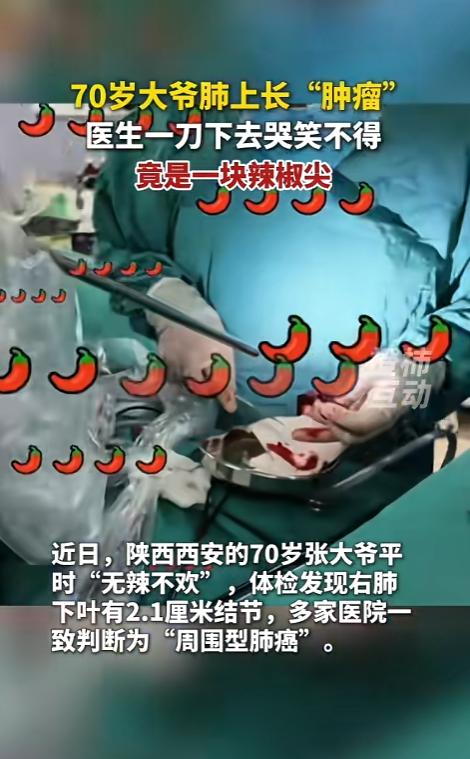 “可把大爷吓够呛！”6月13日报道，陕西西安，一位70岁的大爷在体检时发现肺部长