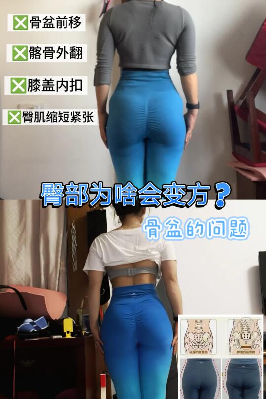 方形臀的真相与改善思路（更深入解析）