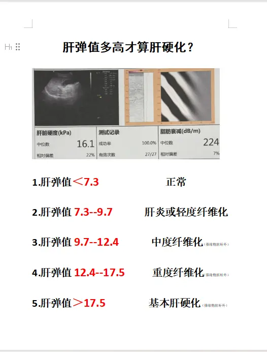 乙肝 肝硬化 肝炎 肝弹值 肝病教授陈士俊