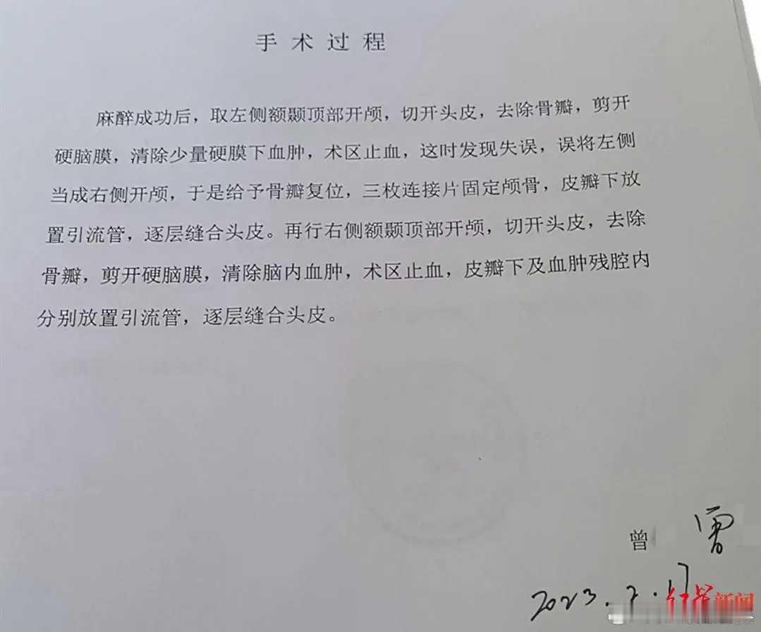 男子右脑出血被医生错开左脑家属称男子三年前右脑出血被开左脑，医生发现出错又开右脑