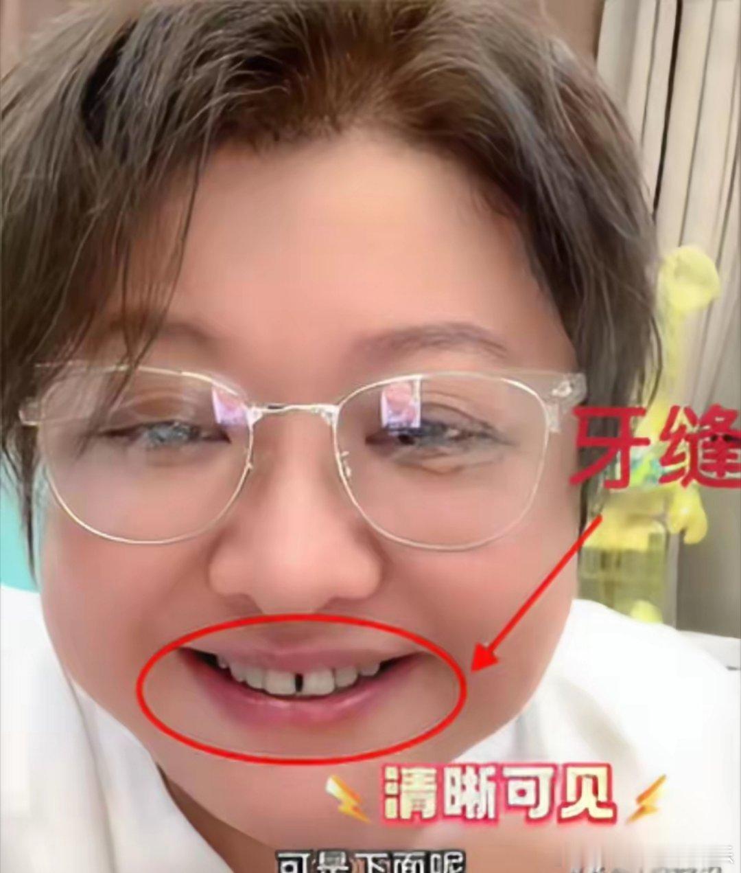 韩红明明这么有钱，住豪/宅、开豪/车，为什么不舍得花钱去补下她的大牙缝？这个原因