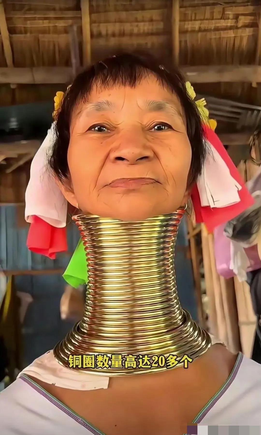 这玩意戴着是为了预防颈椎病吗？