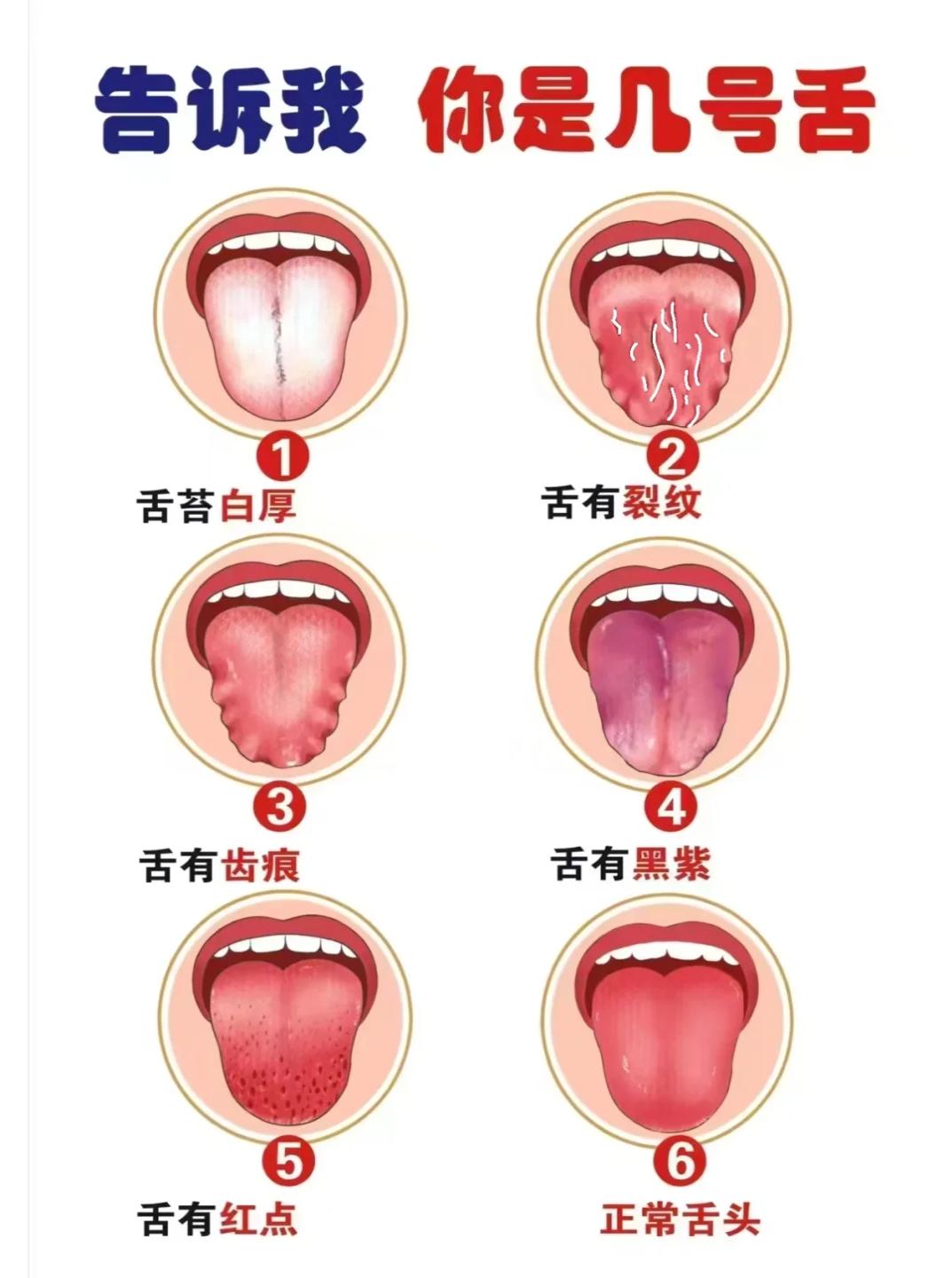 中医有六种常见舌，告诉我你是哪一种？

今天周六，时间很充裕，继续帮大家看舌象！