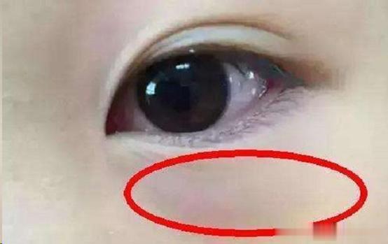 看了上万例身高矮小的孩子，我再强调一遍，不要瞎折腾，几味药就能改善!

经常有家