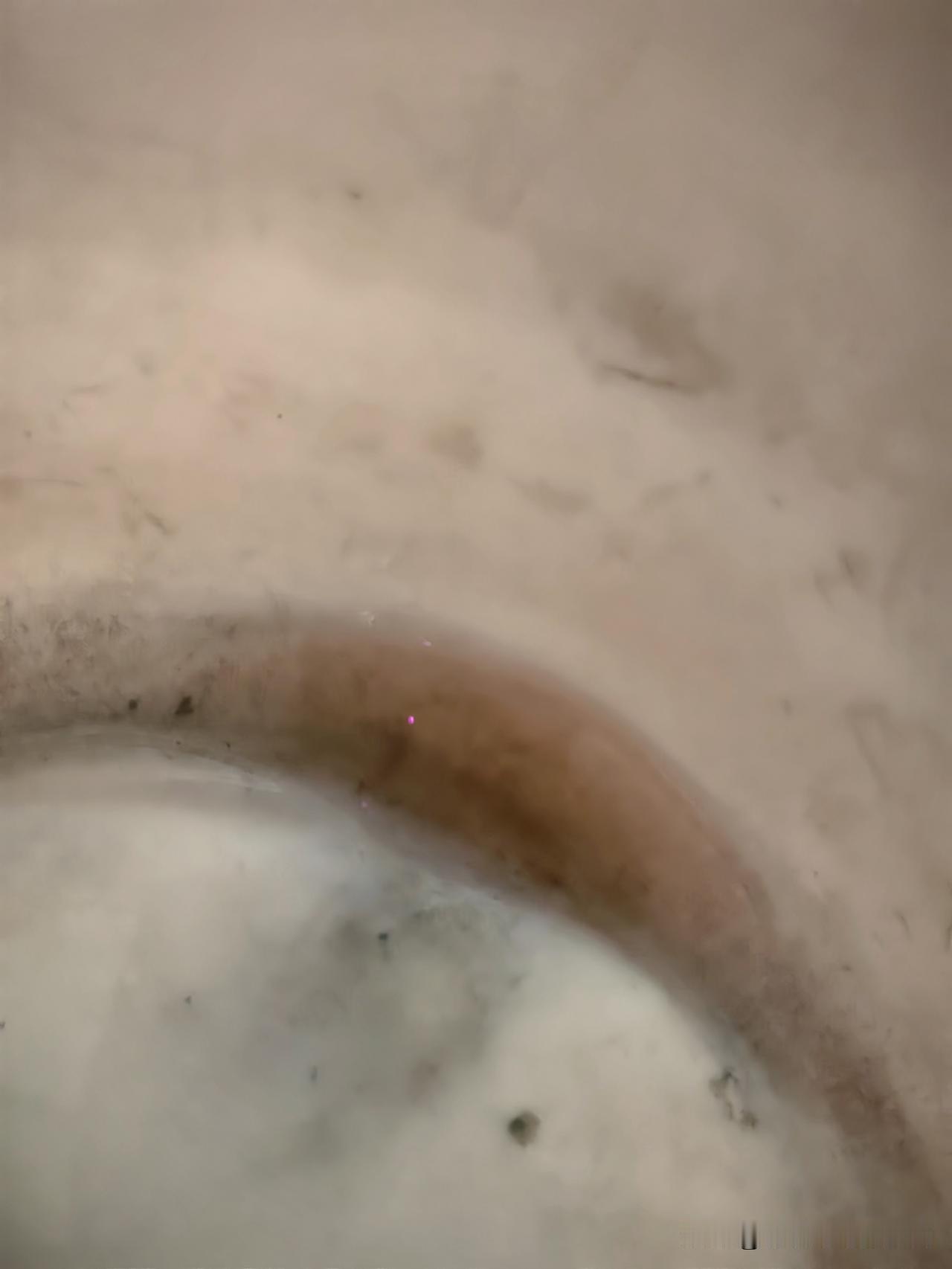 今天早上给瘫痪老公倒尿时发现沉淀的尿是发浅红色的，我跟老公说咋尿里有血了，老公说