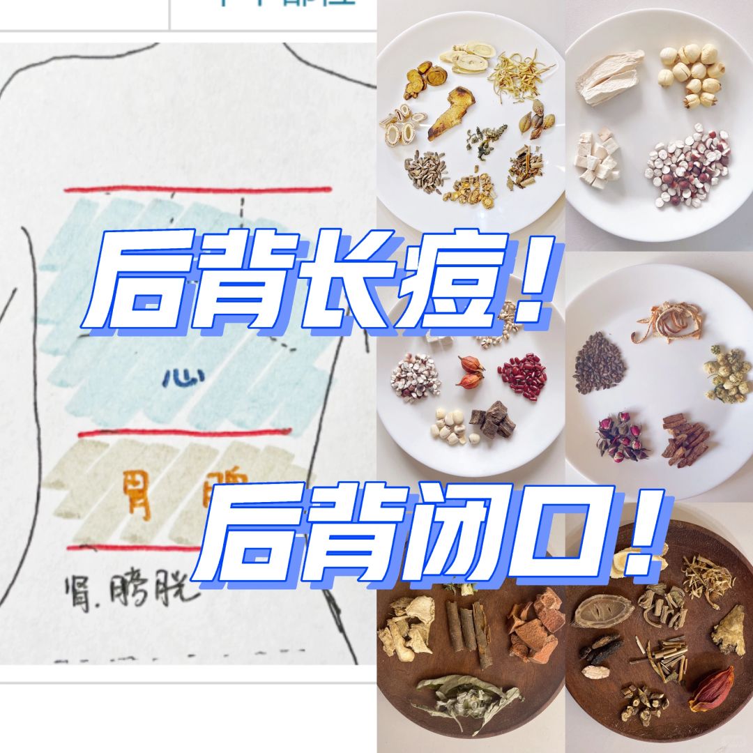 后背：闭口or痘👆分区域、分形态找原因