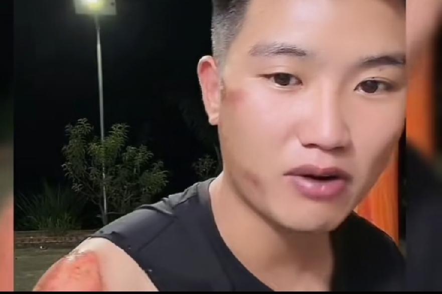 小叔那巴掌举起来的时候，屋里没一个人动。
小潘脸上还带着昨天骑车摔的伤，手臂上擦