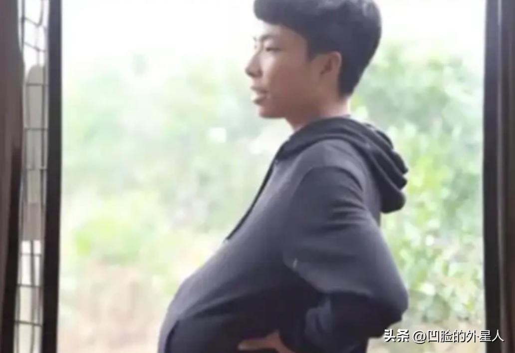 2003年，重庆小伙肚子异常大，被村里人嘲笑怀孕，手术后，男子真生下18斤的“女