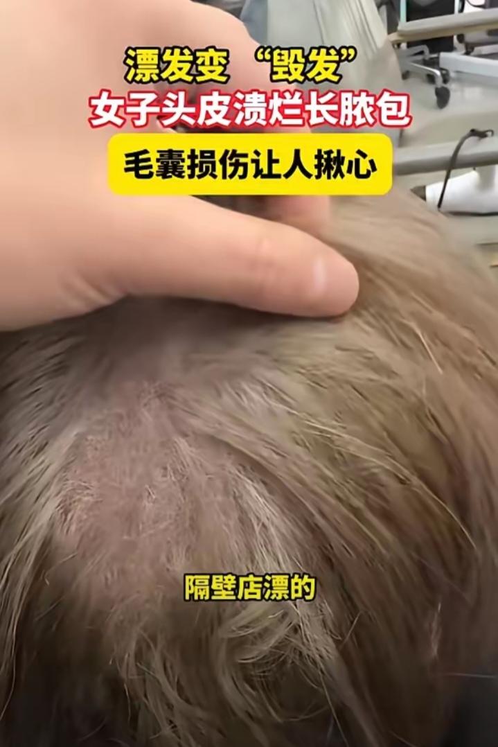 “太吓人了！”近日，上海，一女子去理发店染发，理发师掀开她的头发发现，她里面的头