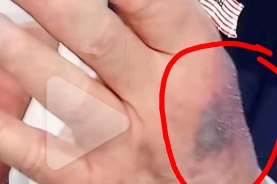 特朗普给阿司匹林“做广告”
外媒消息，日前特朗普表示，他服用了大剂量的阿司匹林，