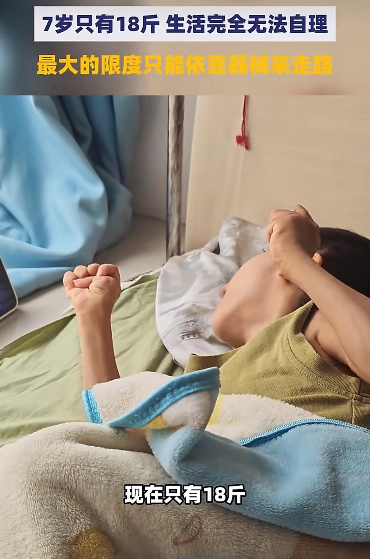 7岁男童仅18斤被当脑瘫治7年这也太离谱了，明明只是外伤骨折，却被诊断为脑瘫，而