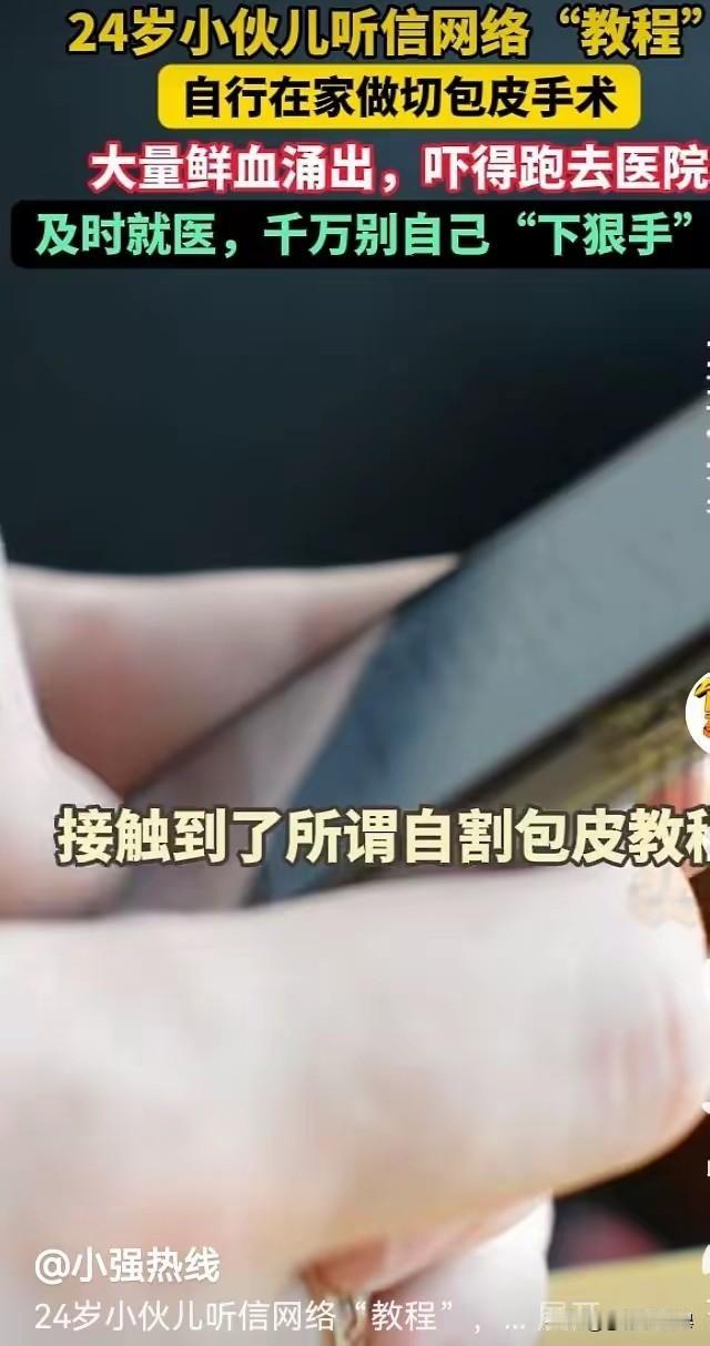 这小伙是个狠人啊！上海。24岁小伙竟然自学包皮切除术，自己挥刀斩小弟！

这小伙