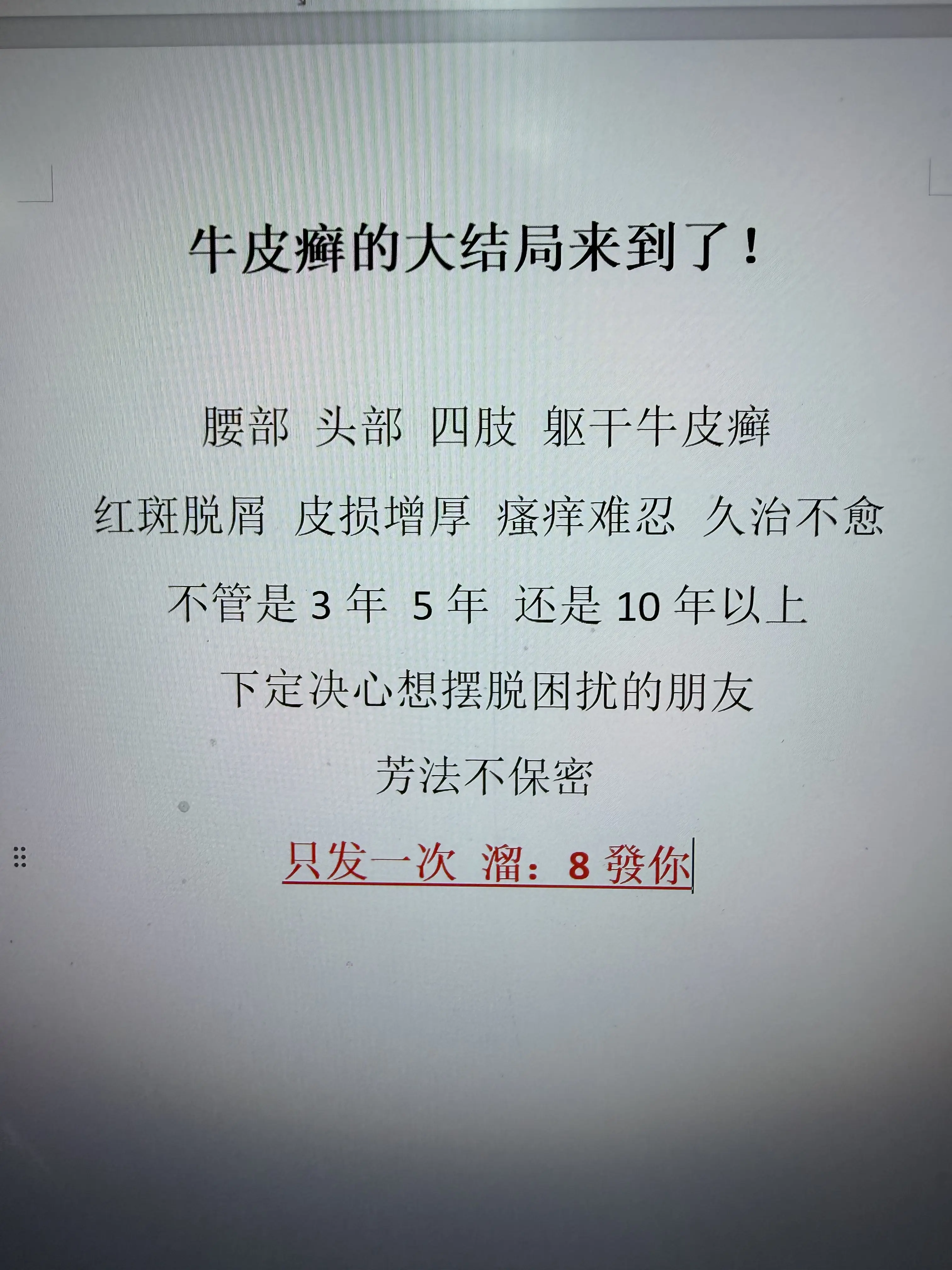 牛皮癣银屑病银屑病患者