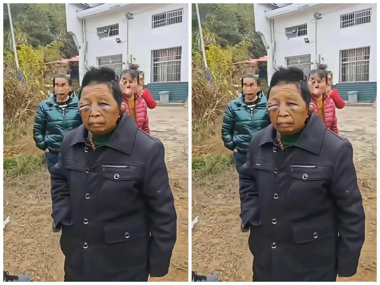 40多岁活成60岁的模样，湖南这位妇女的遭遇看完太揪心！

浑身新旧伤痕交错，眼