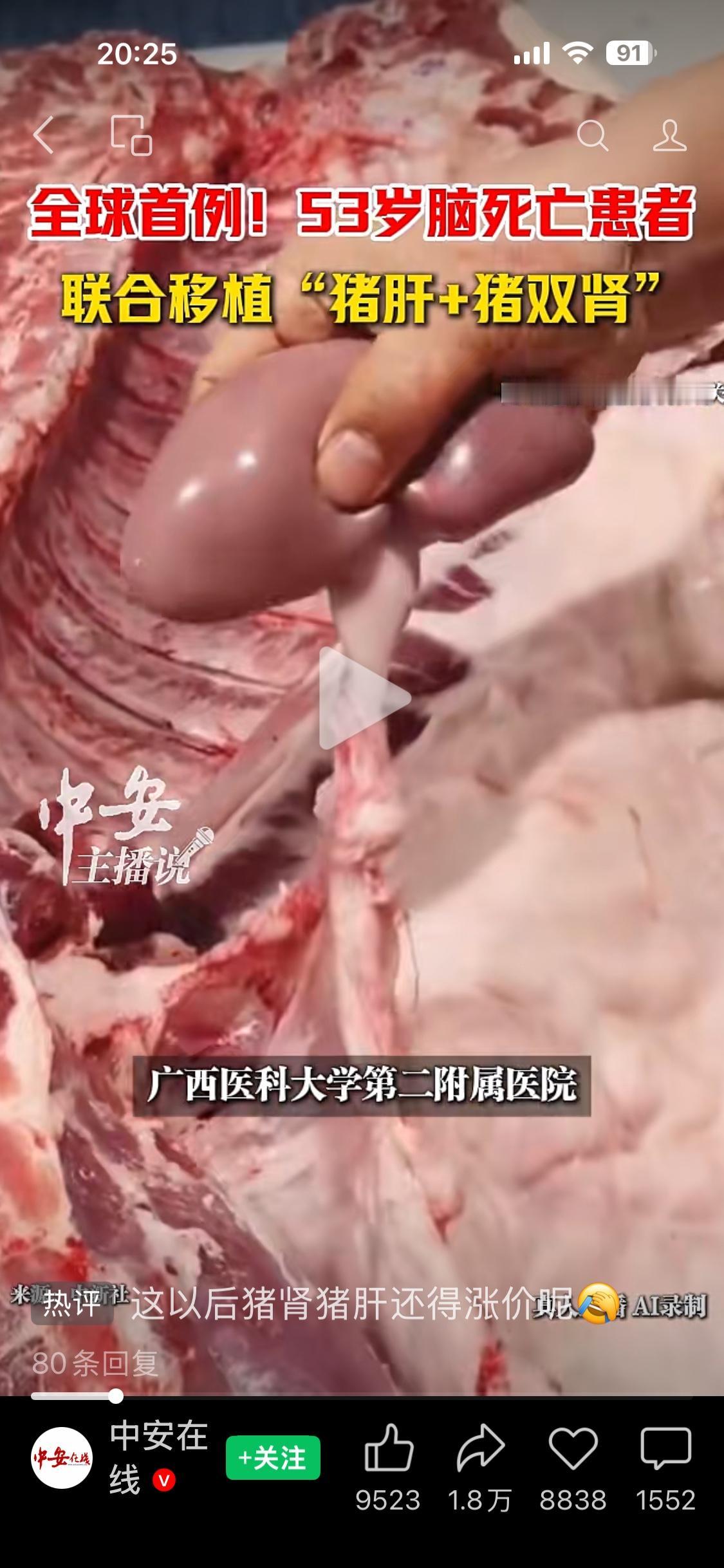 医院从不在体量大小，医者贵在初心担当。广西医科大学第二附属医院再创医学奇迹，两枚