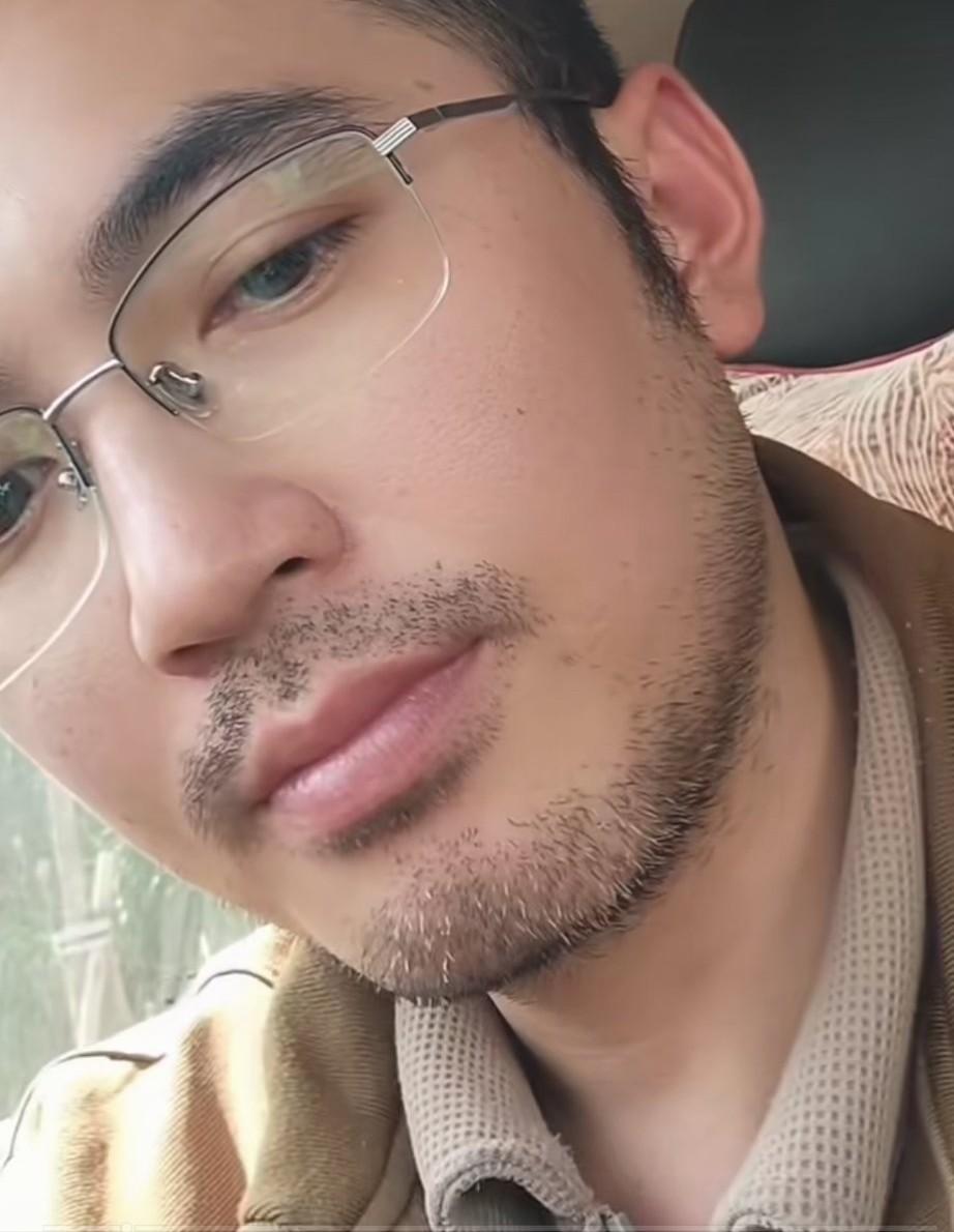 问大家一个问题，男人的衰老是从胡子开始的吗？自从进入50岁以后，就开始出现有白色