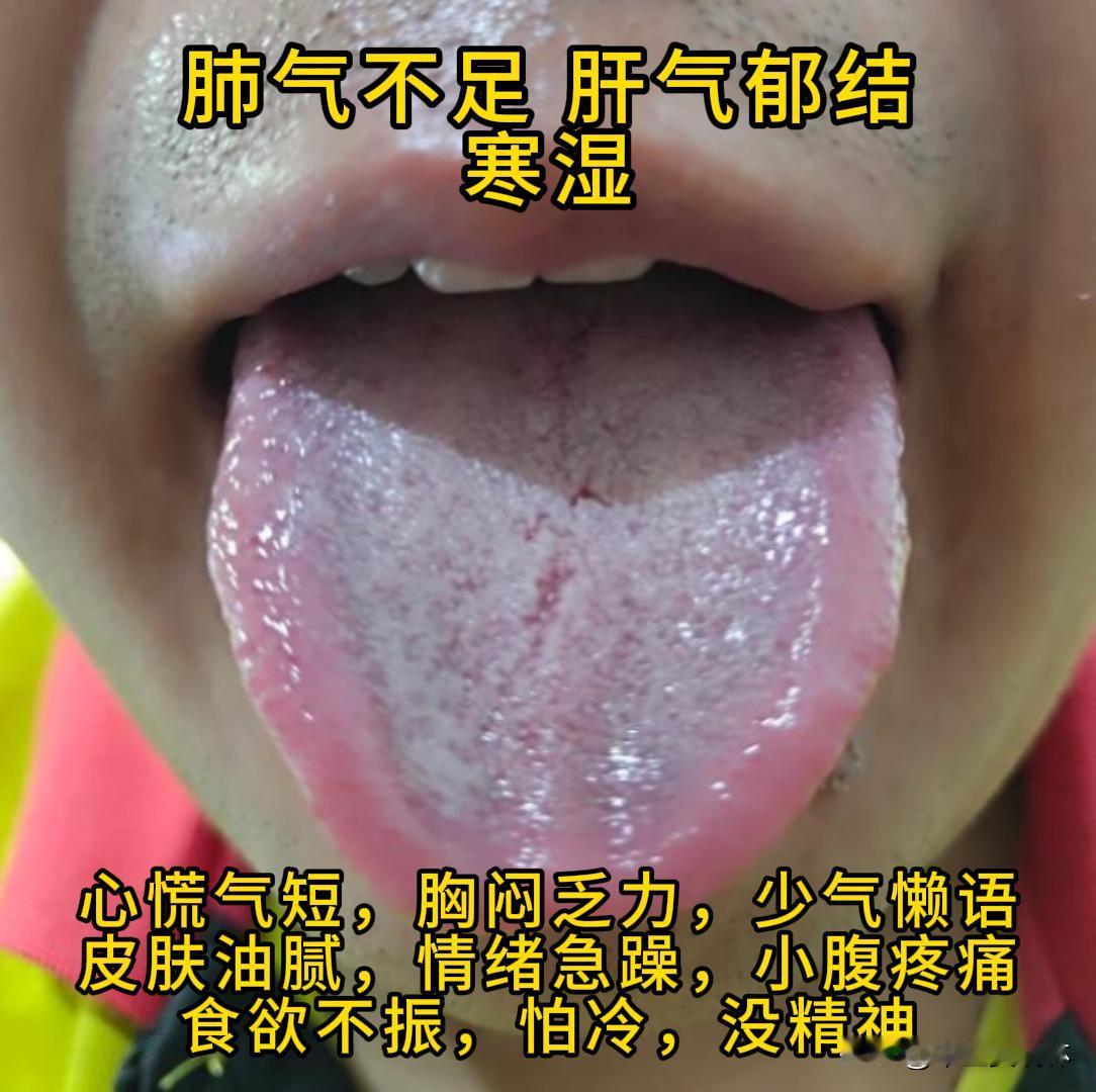 公益舌诊

有需要的，尽管把你的舌象照片发过来吧！越早发，我就能越早给你看。
