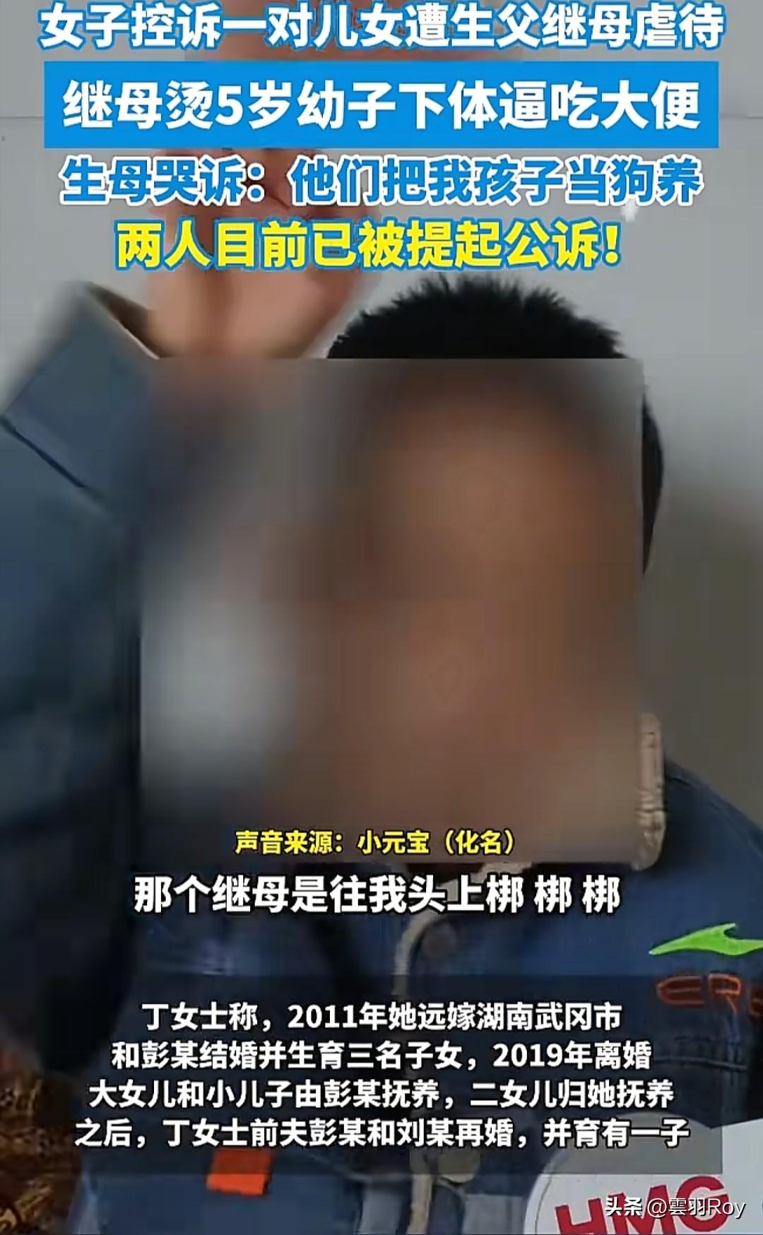 70℃热水泼孩子？这是个烧伤科护士该有的作为？
正常人都知道70℃的水会烫伤，她