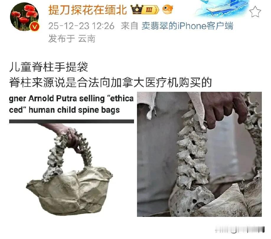 难怪有钱人喜欢移民欧美，原来有钱真的可以为所欲为，连儿童脊椎手提袋都可以买，而且