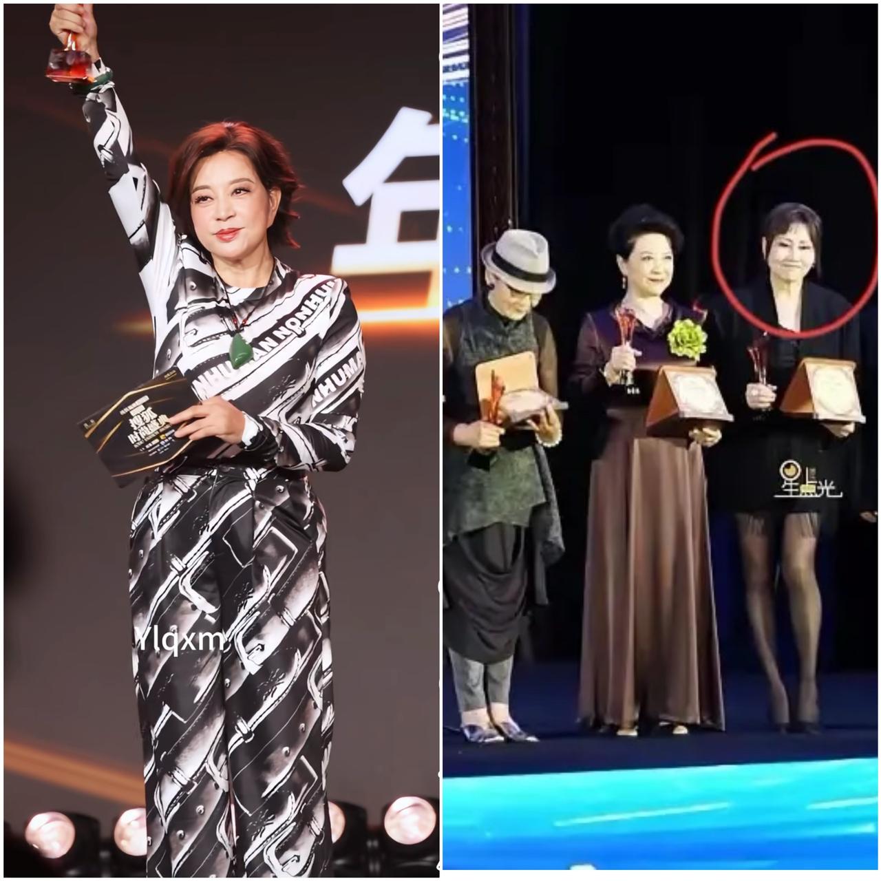 发现了吗，
自信的人根本不用穿丝袜，也可以在舞台上发光的，刘晓庆就给张凯丽狠狠的