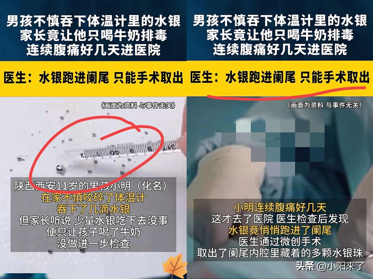 心不是一般的大！陕西西安，一11岁男孩在家玩耍时，意外咬破了体温计，导致吞下了几