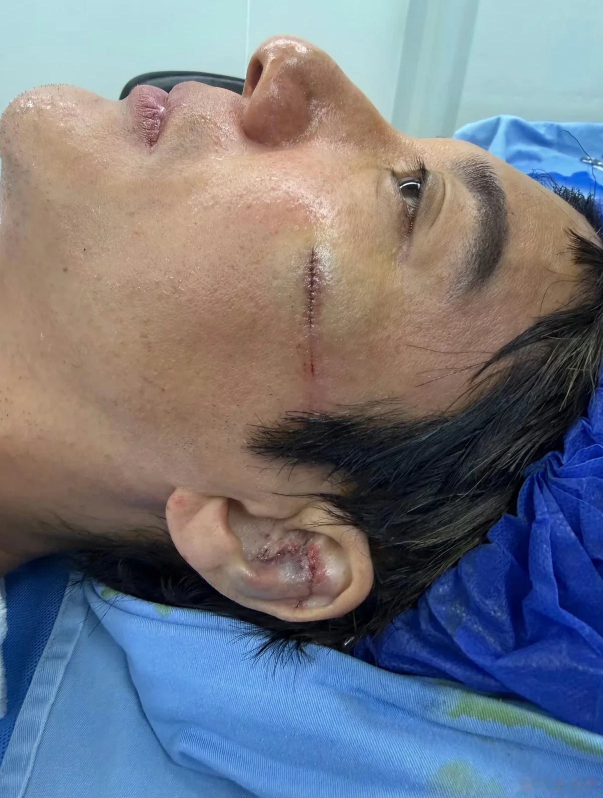 说出来你可能不信，
王力宏唱歌居然唱出玄学来了！
连着好几场演唱会出意外，次次都