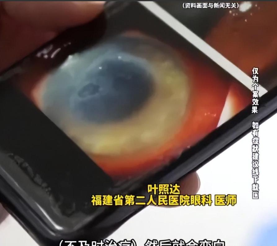 “太吓人了！”福州，一名男子贪凉到野外的溪水游泳，眼睛突发怪病，视力急剧下降，去