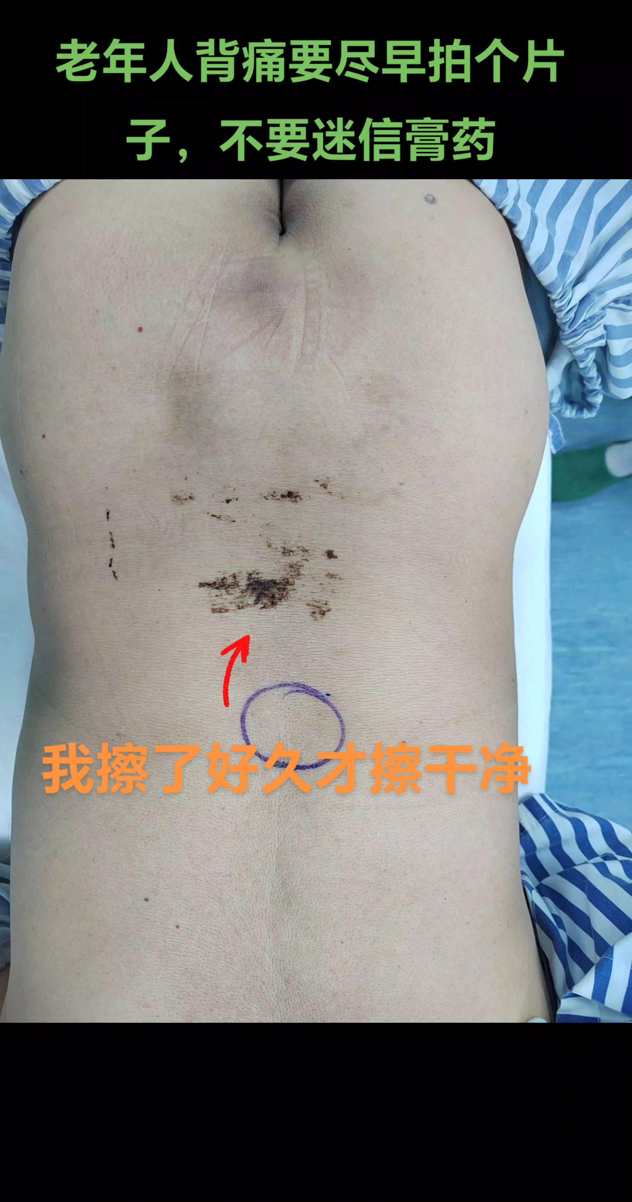 老年人背痛要小心哦。