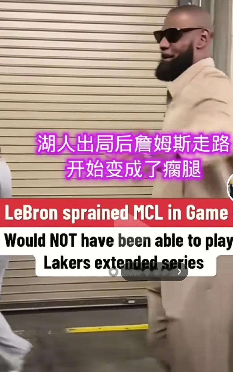 垃圾时间还能快攻上演铁血两分的詹姆斯。
被淘汰后变成了瘸腿詹，并且在路上一瘸一拐