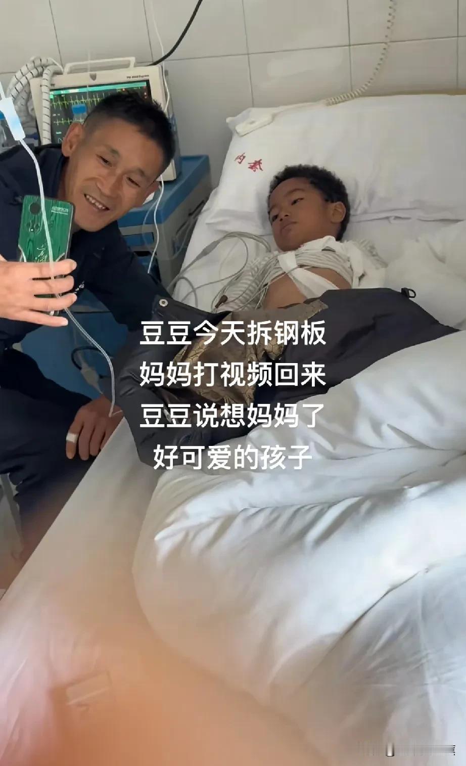 豆豆今天胳膊拆钢板，在医院的病床上，菲利斯从非洲打来视频安慰他。
妈妈不在家，豆