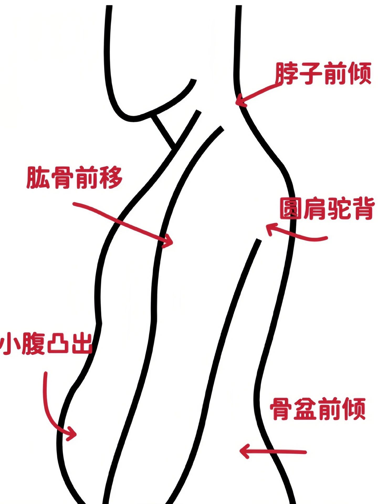 每天练习开肩真的有惊喜。 