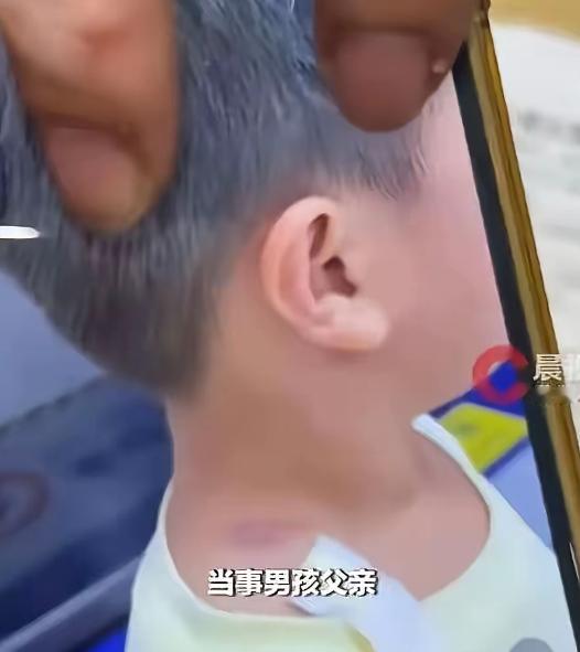 看到 “4 岁男童摸臀” 事件迎来大反转，女子账号被扒出满是吵架视频时，我第一反