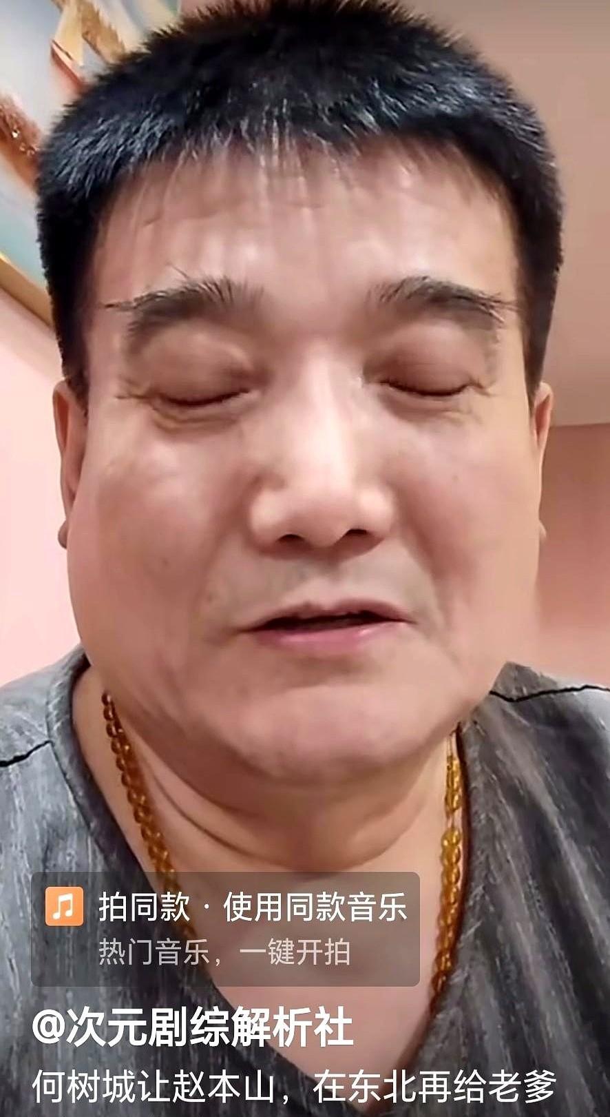 他不是想要第二套房。
他是要亲手砸碎父亲最值钱的东西。
赵本山付了何庆魁多年的医