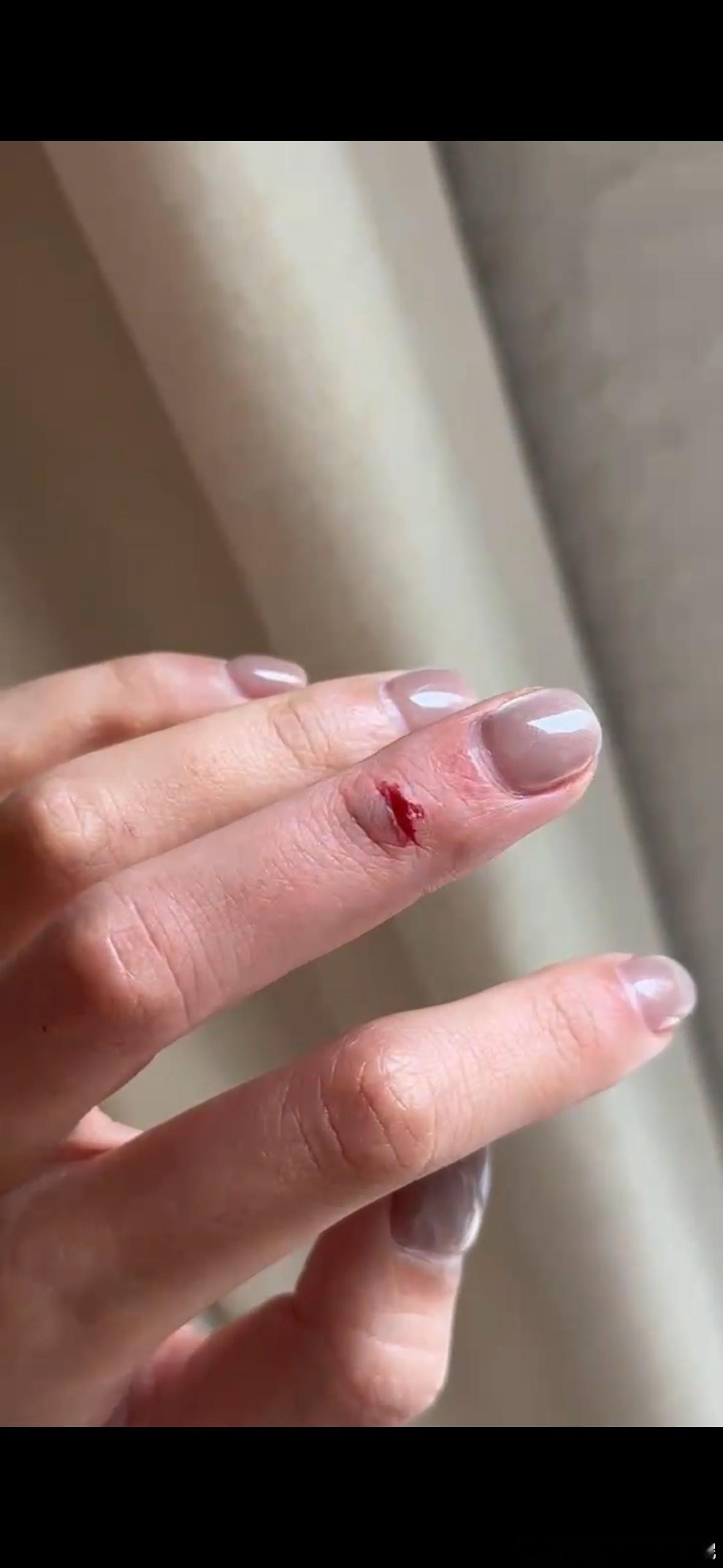 又被门夹了！！！ ​​​