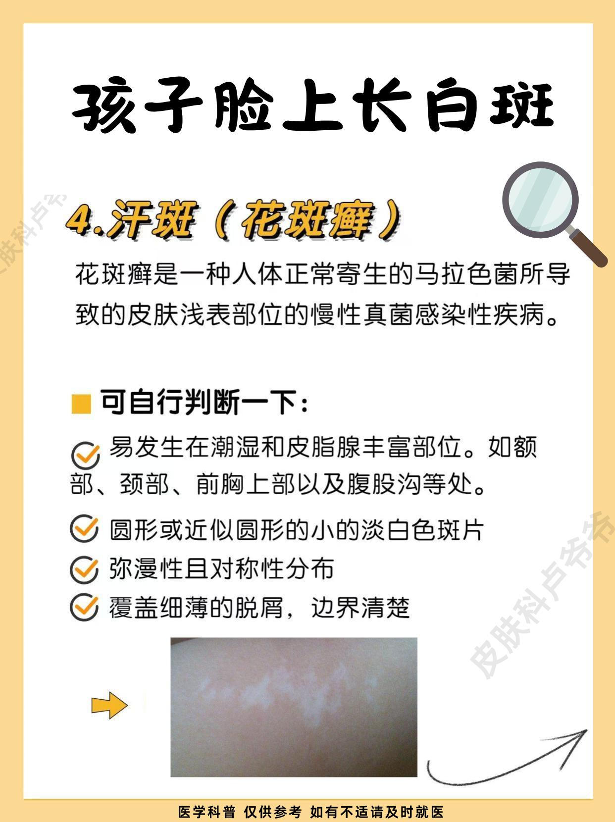 大家注意，这些白斑别搞错了